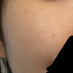 혐 주의) 내 피부 많이 <b>더러움</b>..?