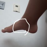 나 <b>발</b>이 자주아픈데 괜찮은거지?