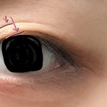 [드루와] <b>쌍</b>커풀 <b>겹</b>생기는거 어케 해결함?