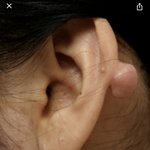 야 너네 피어싱 뚫고 관리 잘<b>해라</b>