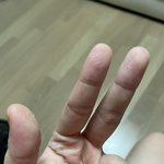 궁금한데 ㄹㅇ 손에 구멍나는 거 <b>머</b>ㅓ임..?