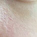 [댓글부탁해] <b>요철</b> 컨실러 추천좀ㅠㅠㅠㅠ