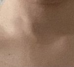 [댓글부탁해] 나 승모근 올라와있는거 많이 <b>심해</b>??