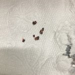 와 나 피어싱 피딱지 오져