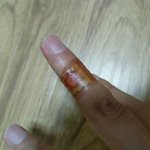 혐주의)손가락등 베임 피 많이 남ㅠㅠ