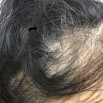 나 머리 많이 <b>비어</b>있냐ㅠ?