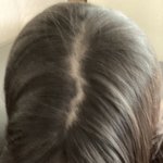 아니 나 ㄹㅇ <b>정수리</b> 좀 위험하지않아?