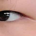 [댓글부탁해] <b>내</b> <b>눈</b> 쌍수하면 ㄱㅊ을 것 같음?