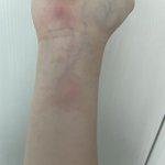 [더보이즈] ㅅㄷ 와 일어났는데 모기한테 두 방 뜯김