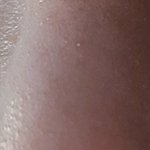 결혼식 앞두고 얼굴조져놓은 압구정 ㅇㅅㅁ <b>클리닉</b>