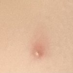 [댓글부탁해] 나 볼에 여드름?<b>이</b> 났는데 <b>안</b>사라짐