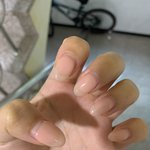 <b>손톱</b> 개짧아짐 슬프다