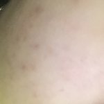 피부과 다녀본애들 있낭