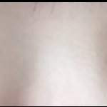 [이것좀봐줘] <b>쌍수</b> 20일 차인데 어때..?