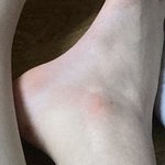 나 <b>복숭아</b>뼈 분홍색임