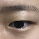 [댓글부탁해] 얘두라 나 <b>눈살</b> 많은건지 좀 봐주라