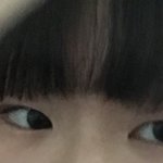눈에 살 많으면 자연적으로 쌍커풀 안생기지? 사진 ㅇ