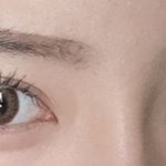 나 이분처럼 눈알 한쪽만 돌아간 <b>사시</b>인데