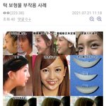[모두드루와] 트와이스 <b>나연</b> 심각한 턱 상태