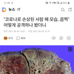 [19] 얘들아 코로나 확진자 폐 <b>해부</b>한거래