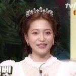예리 <b>팔자</b>주름 뭐임