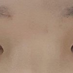 나 눈 쌍수하면 <b>가망</b>잇냐