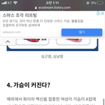 이 부작용은 개<b>이득</b>인가?...