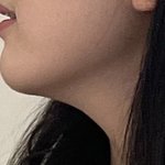 [댓글부탁해] 얘들아 나 <b>무턱</b>이야?