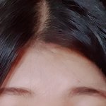 [이것좀봐줘] <b>헤어</b>라인 레이저 제모한거 후회 중인데 봐주라..