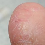 혐주의 내<b>발가락</b> 문제잇어보이냐