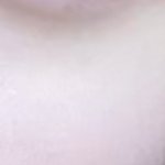 나 피부 개 <b>창백</b>함