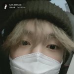 [NCT즌] 다같이 이 아이의 <b>쌍수</b>를 말려라