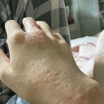 [꼭조언부탁] 무슨 <b>피부병</b>이야 대체