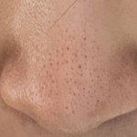 나보다 블랙<b>헤드</b> 심한 사람 있냐….