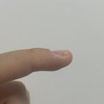 [댓글부탁해] <b>손톱</b>이 위로 자라는데ㅠㅠㅠ
