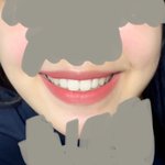 나 교정해 <b>말아</b>?? 빅엿스트레스