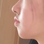 나 <b>무턱</b> 많이 심한지 좀 봐줭