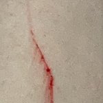 얘두라 나 <b>피나</b> ㅅㅂㅠㅠㅠㅠㅠㅠㅠㅠㅠ