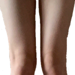 이런 <b>종아리</b>는 어떻게 해야 해? ㅠㅠ