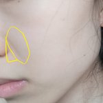 내 피부 조카좋음