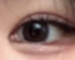 [댓글부탁해] ++앞트임한거ㅠㅠㅠ