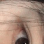 [댓글부탁해] <b>빛삭</b>)쌍수 티나는 편이야??