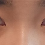 [댓글부탁해] 코 성형 할까