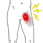 [댓글부탁해] 얘들아 사타구니에 <b>멍울</b> 잡히는데 이거 뭔지 아는 사람ㅜㅠ