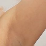 [꼭조언부탁] 사진주의)겨드랑이 <b>착색</b> 심한가ㅠㅠㅠ