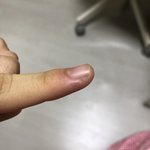 [댓글부탁해] 이거 뭐야?엄청 <b>아파</b>