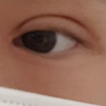 쌍수 8<b>달차</b>인데 좀 봐줘..