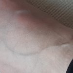 [ㅈㄱㄴ] ㅅㅂ 나 조카 무슨 <b>헐크</b>임