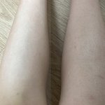 <b>닭살</b>마냥 다리에 털 박힌 애들아 꼭 봐라