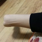 나 <b>손목</b> 한쪽 없는데 보기흉해?..